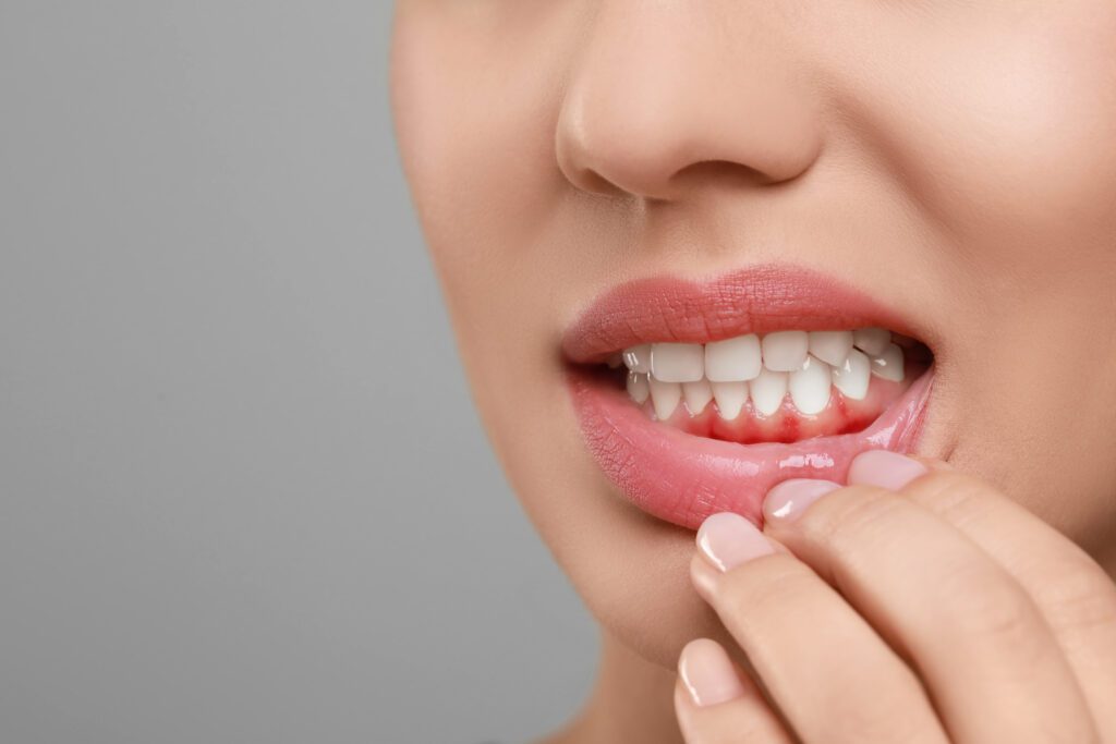 bleeding gums in Alexandria