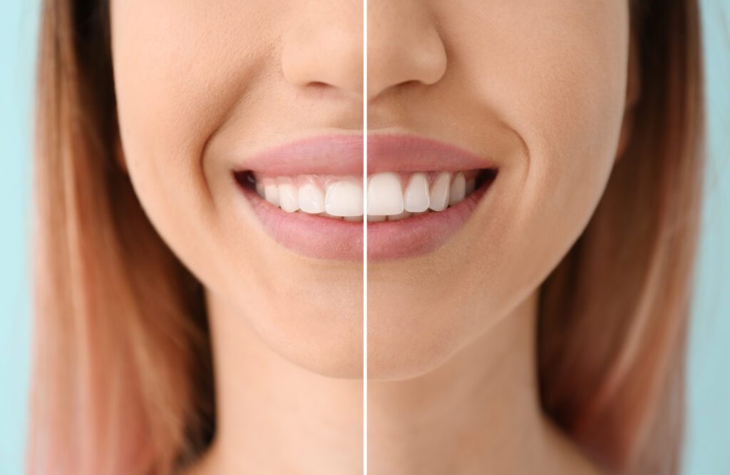 gum specialist Alexandria